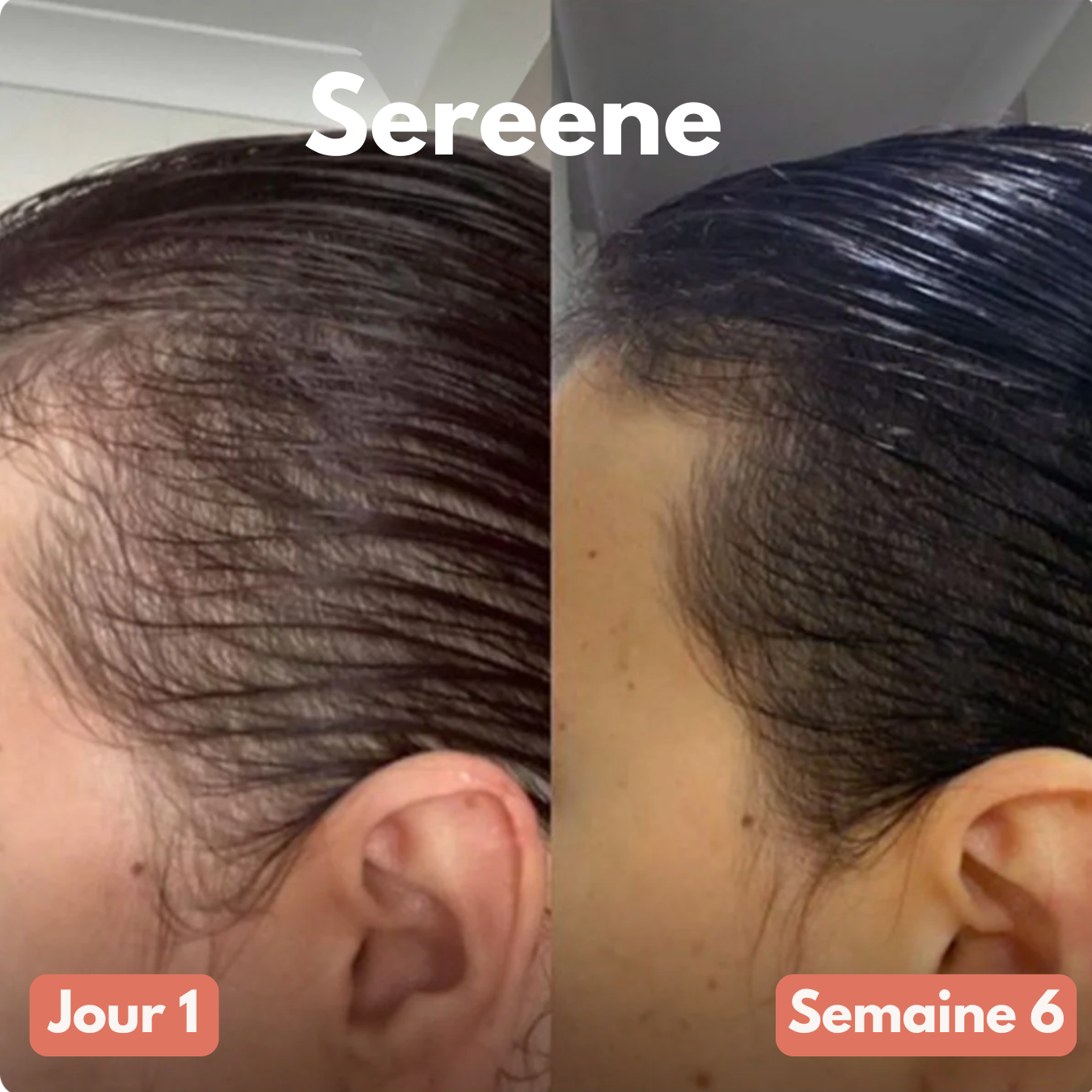 Gélule d’Huile de Pépin de Courge