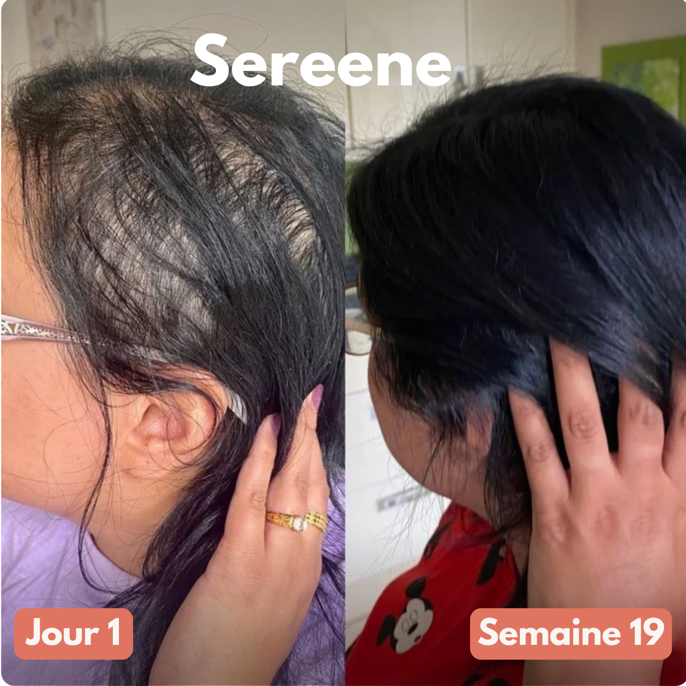 Gélule d’Huile de Pépin de Courge